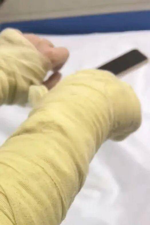 湖南一女主播被伪装的包裹炸伤,永州公安:正在核实具体情况