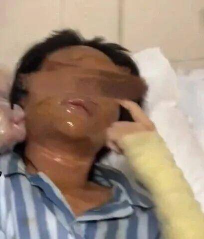 湖南一女主播被伪装的包裹炸伤,永州公安:正在核实具体情况